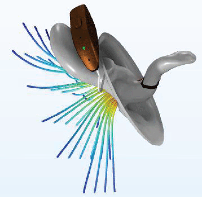 Streamlines of the intensity of the acoustic field leaking from the ear canal with hearing aid.