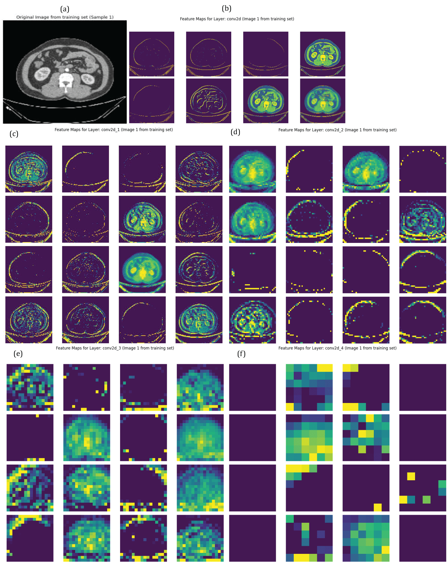 Feature Maps of Five Convolutional Layers obtained from deep CNN model (a) original image (b) convolutional layer1 output (c) convolutional layer2 output (d) convolutional layer3 output (e) convolutional layer4 output (f) convolutional layer5 output.