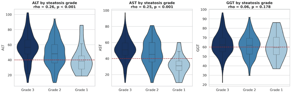 Distribution of liver biochemical markers across imaging-defined steatosis grades. Violin plots with overlaid box plots compare alanine aminotransferase, aspartate aminotransferase, and gamma-glutamyl transferase across Grades 1&ndash;3. Horizontal reference lines indicate approximate upper limits of normal. Alanine and aspartate aminotransferase show ordered upward shifts, whereas gamma-glutamyl transferase does not show a statistically significant linear trend (p = 0.134).